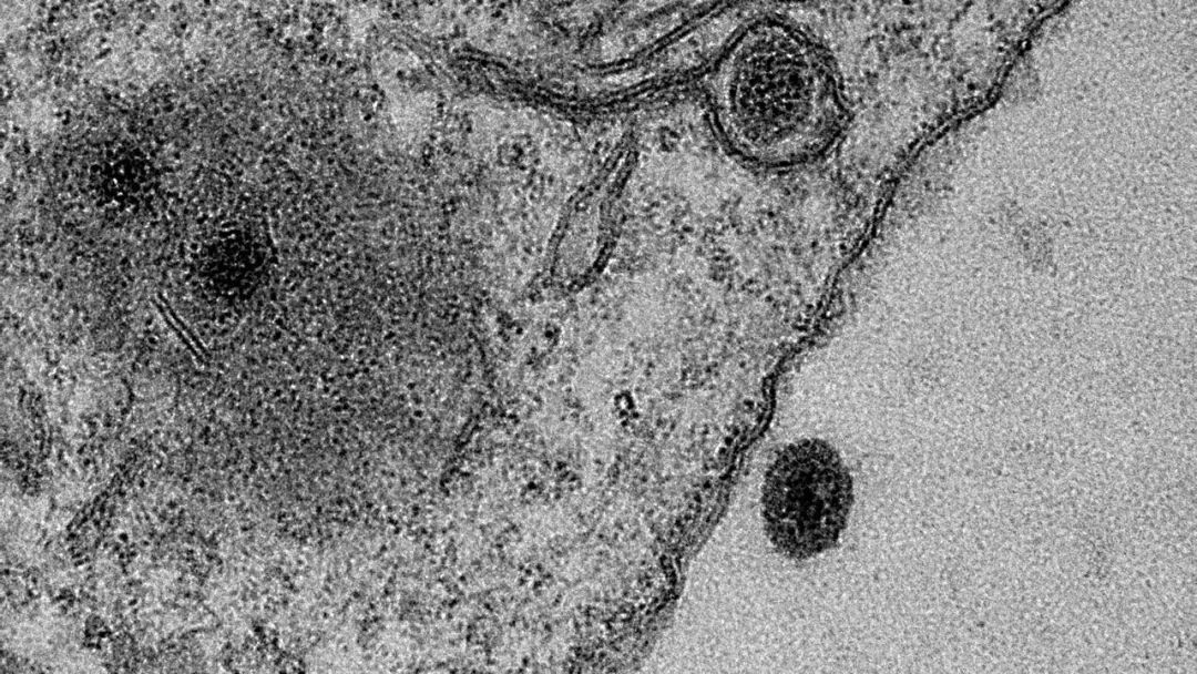 雅拉病毒（深色）感染变形虫（来源：Science）