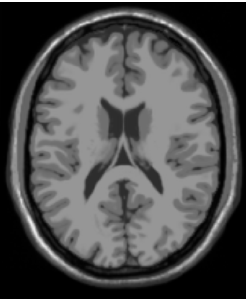 BrainWeb: Simulated Brain Database使用说明