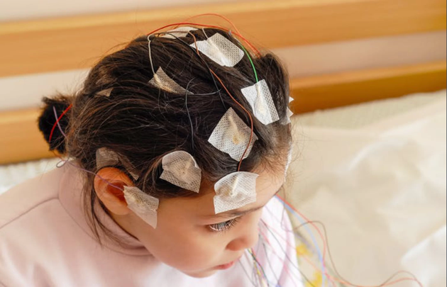 外接电极可以记录大脑活动。