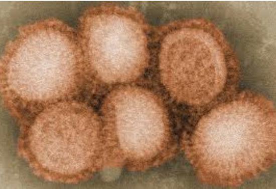  2009 年猪流感 H1N1 病毒
